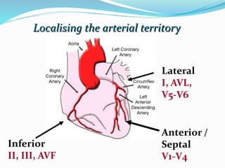 Localising the arterial territory
Inferior
II, III, AVF
Lateral
I, AVL,
V5-V6
Anterior /
Septal
V1-V4
 