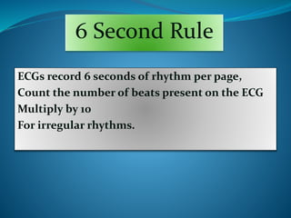 6 Second Rule
ECGs record 6 seconds of rhythm per page,
Count the number of beats present on the ECG
Multiply by 10
For irregular rhythms.
 