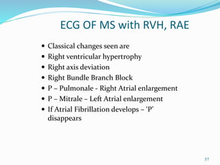 57
ECG OF MS with RVH, RAE
 Classical changes seen are
 Right ventricular hypertrophy
 Right axis deviation
 Right Bundle Branch Block
 P – Pulmonale - Right Atrial enlargement
 P – Mitrale – Left Atrial enlargement
 If Atrial Fibrillation develops – ‘P’
disappears
 