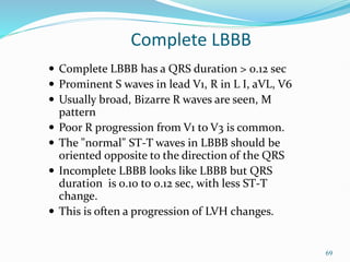 69
Complete LBBB
 Complete LBBB has a QRS duration > 0.12 sec
 Prominent S waves in lead V1, R in L I, aVL, V6
 Usually broad, Bizarre R waves are seen, M
pattern
 Poor R progression from V1 to V3 is common.
 The "normal" ST-T waves in LBBB should be
oriented opposite to the direction of the QRS
 Incomplete LBBB looks like LBBB but QRS
duration is 0.10 to 0.12 sec, with less ST-T
change.
 This is often a progression of LVH changes.
 