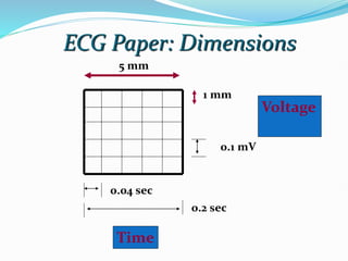 ECG Paper: Dimensions
5 mm
1 mm
0.1 mV
0.04 sec
0.2 sec
Time
Voltage
 