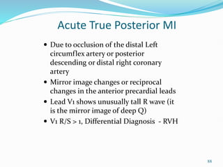 88
 Due to occlusion of the distal Left
circumflex artery or posterior
descending or distal right coronary
artery
 Mirror image changes or reciprocal
changes in the anterior precardial leads
 Lead V1 shows unusually tall R wave (it
is the mirror image of deep Q)
 V1 R/S > 1, Differential Diagnosis - RVH
Acute True Posterior MI
 
