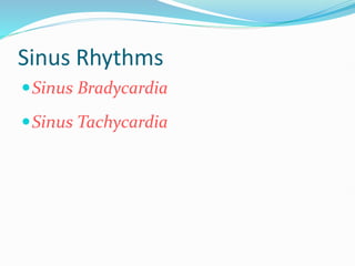 Sinus Rhythms
Sinus Bradycardia
Sinus Tachycardia
 