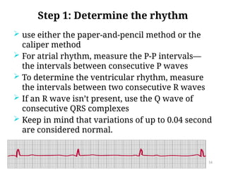 Two Consecutive R Waves Basic Electrocardiography (ECG) interpretation | PPTX