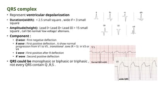 QRS complex
• Represent ventricular depolarization
• Duration(width): < 2.5 small square , wide if > 3 small
square
• Amplitude(height): Lead I+ Lead II+ Lead III > 15 small
square , can be normal/ low voltage/ alternans.
• Component :
• Q wave : First negative deflection
• R wave : First positive deflection , it show normal
progression from V1 to V5 , transitional zone (R = S) in V3 or
V4
• S wave : First positive after R deflection
• R’ wave : Second positive deflection
• QRS could be monophasic or biphasic or triphasic ,
not every QRS contain Q ,R,S .
 