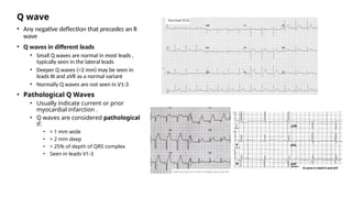 Q wave
• Any negative deflection that precedes an R
wave
• Q waves in different leads
• Small Q waves are normal in most leads ,
typically seen in the lateral leads
• Deeper Q waves (>2 mm) may be seen in
leads III and aVR as a normal variant
• Normally Q waves are not seen in V1-3
• Pathological Q Waves
• Usually indicate current or prior
myocardial infarction .
• Q waves are considered pathological
if:
• > 1 mm wide
• > 2 mm deep
• > 25% of depth of QRS complex
• Seen in leads V1-3
 