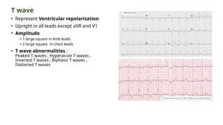 T wave
• Represent Ventricular repolarization
• Upright in all leads except aVR and V1
• Amplitude
< 1 large square in limb leads
< 2 large square in chest leads
• T wave abnormalities :
Peaked T waves , Hyperacute T waves ,
Inverted T waves , Biphasic T waves ,
Flattened T waves
 