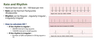 Rate and Rhythm
• Normal heart rate : 60 – 100 beat per min
• Rate can be Normal /Tachycardia
/Bradycardia
• Rhythm can be Regular , regularly irregular ,
irregularly irregular
• How to calculate HR ?
• If the rhythm is regular :
• 300/RR interval in big squares.
• 1500/RR interval in small squares
• If the rhythm is irregular :
• Number of QRS complexes in 30 big square x
10.
 
