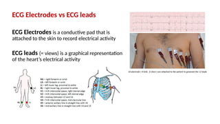 ECG Electrodes vs ECG leads
ECG Electrodes is a conductive pad that is
attached to the skin to record electrical activity
ECG leads (= views) is a graphical representation
of the heart’s electrical activity
 