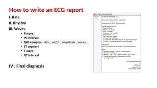 How to write an ECG report
I. Rate
II. Rhythm
III. Waves
• P wave
• PR interval
• QRS complex ( Axis , width , amplitude , waves )
• ST segment
• T wave
• QT interval
IV : Final diagnosis
 