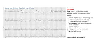 ECG Report
Rate : 300/3.5 = 85 beat per minute
Rhythm: Regular, normal sinus rhythm
waves :
• P wave: Normal P wave morphology and
axis , each P wave followed by QRS.
• PR interval : Normal , constant .
• QRS complex ( Axis , width , amplitude ,
waves ) : Normal
• T wave : Normal
• ST segment : Normal , isoelectric
• QT interval : Normal
Final diagnosis : Normal ECG
 