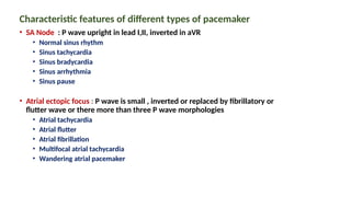 Characteristic features of different types of pacemaker
• SA Node : P wave upright in lead I,II, inverted in aVR
• Normal sinus rhythm
• Sinus tachycardia
• Sinus bradycardia
• Sinus arrhythmia
• Sinus pause
• Atrial ectopic focus : P wave is small , inverted or replaced by fibrillatory or
flutter wave or there more than three P wave morphologies
• Atrial tachycardia
• Atrial flutter
• Atrial fibrillation
• Multifocal atrial tachycardia
• Wandering atrial pacemaker
 
