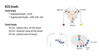ECG leads
Limb leads
• Standard leads : I,II,III
• Augmented leads : aVR, aVF, aVL
Chest leads
V1-V2 : Septal view of the heart
V3-V4 : Anterior view of the heart
V5-V6 : Lateral view of heart
 