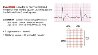 ECG paper is divided by heavy vertical and
horizontal lines into big squares , each big square
is subdivided into 5 small squares.
Calibration : Duration (Time) X Voltage(Amplitude)
Small square : 1mm X 1mm (40ms X 0.1mV)
Large square : 5mm X 5 mm ( 200ms X 0.5 mV )
• 5 large square = 1 second
• 300 large square = 60 second (1 minute )
 