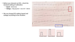 • Before you interpret an ECG , check the
standard setting of calibration:
• Speed : 25mm/sec
• Voltage : 2 big squares = one mV = 10mm
• We can change ECG setting (speed and
voltage) according to the situation
 