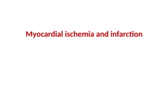 Myocardial ischemia and infarction
 