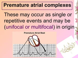 These may occur as single or
repetitive events and may be
(unifocal or multifocal) in origin
Premature atrial complexes
 