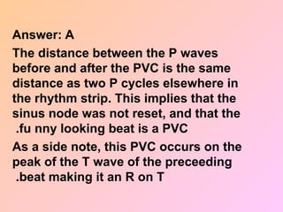 Answer: A
The distance between the P waves
before and after the PVC is the same
distance as two P cycles elsewhere in
the rhythm strip. This implies that the
sinus node was not reset, and that the
fu nny looking beat is a PVC
.
As a side note, this PVC occurs on the
peak of the T wave of the preceeding
beat making it an R on T
.
 