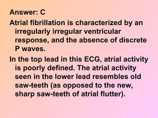 Answer: C
Atrial fibrillation is characterized by an
irregularly irregular ventricular
response, and the absence of discrete
P waves.
In the top lead in this ECG, atrial activity
is poorly defined. The atrial activity
seen in the lower lead resembles old
saw-teeth (as opposed to the new,
sharp saw-teeth of atrial flutter).
 