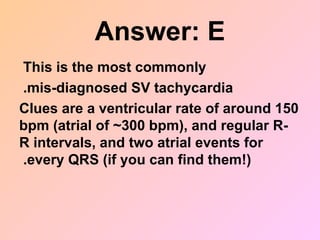 Answer: E
This is the most commonly
mis-diagnosed SV tachycardia
.
Clues are a ventricular rate of around 150
bpm (atrial of ~300 bpm), and regular R-
R intervals, and two atrial events for
every QRS (if you can find them!)
.
 