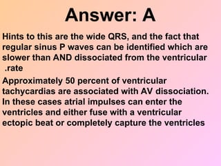 Answer: A
Hints to this are the wide QRS, and the fact that
regular sinus P waves can be identified which are
slower than AND dissociated from the ventricular
rate
.
Approximately 50 percent of ventricular
tachycardias are associated with AV dissociation.
In these cases atrial impulses can enter the
ventricles and either fuse with a ventricular
ectopic beat or completely capture the ventricles
 