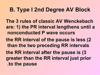 B. Type I 2nd Degree AV Block
The 3 rules of classic AV Wenckebach
are: 1) the PR interval lengthens until a
nonconducted P wave occurs
2
)
the RR interval of the pause is less
than the two preceding RR intervals
3
)
the RR interval after the pause is
greater than the RR interval just prior
to the pause
.
 