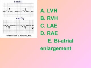 A. LVH
B. RVH
C. LAE
D. RAE
E. Bi-atrial
enlargement
 