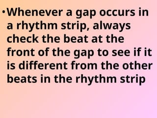 •Whenever a gap occurs in
a rhythm strip, always
check the beat at the
front of the gap to see if it
is different from the other
beats in the rhythm strip
 