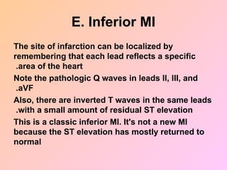 E. Inferior MI
The site of infarction can be localized by
remembering that each lead reflects a specific
area of the heart
.
Note the pathologic Q waves in leads II, III, and
aVF
.
Also, there are inverted T waves in the same leads
with a small amount of residual ST elevation
.
This is a classic inferior MI. It's not a new MI
because the ST elevation has mostly returned to
normal
 