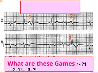 What are these Games 1- ?1
….2- ?!.... 3- ?!
 