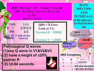 Pathological Q waves
(1)any Q wave in V1&V2&V3
(2) have a height of <25%
partner R
(3) <0.04 seconds.
RVH RAD, and V1 R wave > 7mm tall
LVH R in V5 (or V6) + S in V1 (or V2)
>
35
,
or
avL R > 13 mm
QRS 1-2.5
P > 2.5×2.5
PR 3-5
A QT > half of the
RR interval
QRS > 0.12sec
Look at V1:
Terminal R = RBBB
Terminal S = LBBB
QRS Complexes
I II Axis
+ + normal
+ - left axis deviation
- + right axis deviation
RATE
RHYTHM
AXIS
INTERVALS
(P-PR-QRS-QT)
HYPERTROPHY
MI
lateral
Leads I, aVL, and V5- V6
.
Anterior
leads V1-V4
Inferior
Leads II, III aVF
 