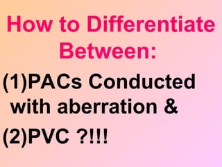 (1)PACs Conducted
with aberration &
(2)PVC ?!!!
How to Differentiate
Between:
 