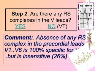 Comment:. Absence of any RS
complex in the precordial leads
V1..V6 is 100% specific for VT,
but is insensitive (26%)
.
Step 2: Are there any RS
complexes in the V leads?
NO (VT)
YES
 