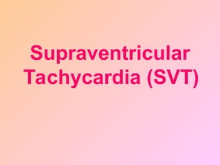 Supraventricular
Tachycardia (SVT)
 