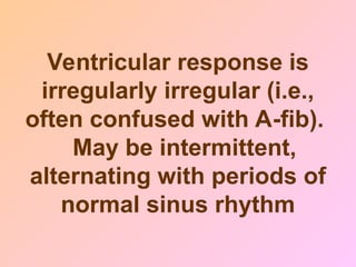 Ventricular response is
irregularly irregular (i.e.,
often confused with A-fib).
May be intermittent,
alternating with periods of
normal sinus rhythm
 