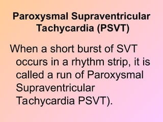 Paroxysmal Supraventricular
Tachycardia (PSVT)
When a short burst of SVT
occurs in a rhythm strip, it is
called a run of Paroxysmal
Supraventricular
Tachycardia PSVT).
 