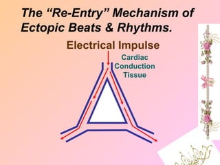 The “Re-Entry” Mechanism of
Ectopic Beats & Rhythms.
Electrical Impulse
Cardiac
Conduction
Tissue
 