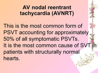 AV nodal reentrant
tachycardia (AVNRT)
This is the most common form of
PSVT accounting for approximately
50% of all symptomatic PSVTs.
It is the most common cause of SVT in
patients with structurally normal
hearts.
 