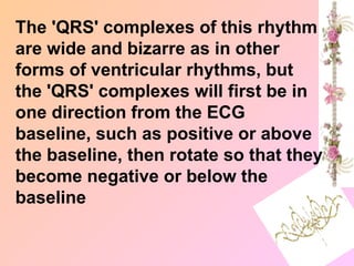 The 'QRS' complexes of this rhythm
are wide and bizarre as in other
forms of ventricular rhythms, but
the 'QRS' complexes will first be in
one direction from the ECG
baseline, such as positive or above
the baseline, then rotate so that they
become negative or below the
baseline
 