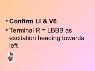 • Confirm LI & V6
• Terminal R = LBBB as
excitation heading towards
left
 