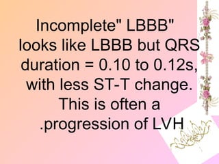 "
Incomplete" LBBB
looks like LBBB but QRS
duration = 0.10 to 0.12s,
with less ST-T change.
This is often a
progression of LVH
.
 