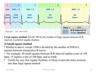 ECG....pptx ECG ALSO KNOWN AS ELECTOCARDIOGRAPHY | PPTX