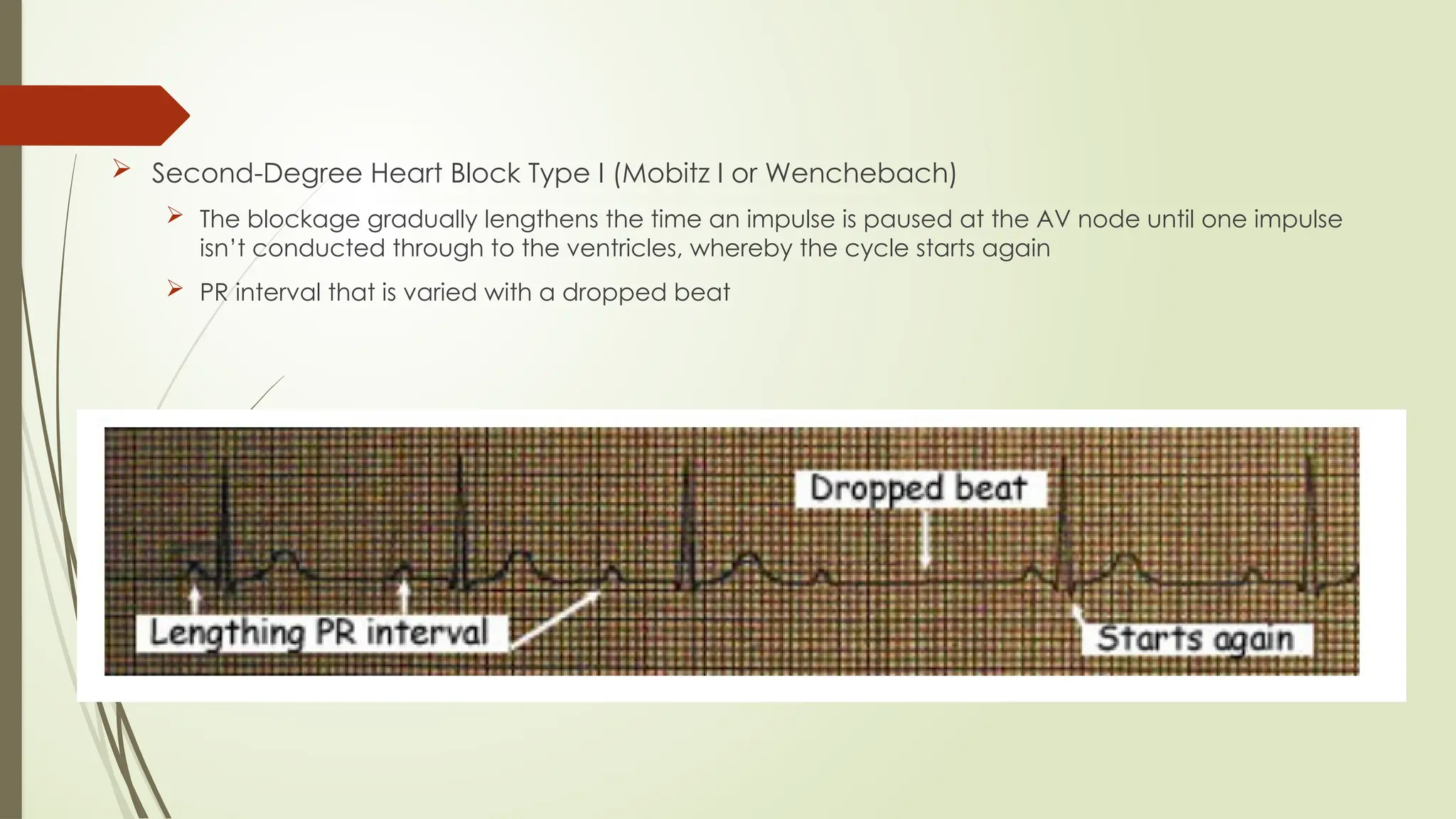 ECG reading and interpretation for beginners.pptx