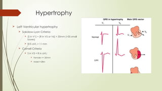 Hypertrophy
 Left Ventricular hypertrophy
 Sokolow-Lyon Criteria:
 [S in V1] + [R in V5 or V6] > 35mm (>35 small
boxes)
 R in aVL > 11 mm
 Cornell Criteria
 S in V3 + R in aVL:
 Female >= 20mm
 Male>=28m
 