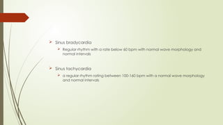  Sinus bradycardia
 Regular rhythm with a rate below 60 bpm with normal wave morphology and
normal intervals
 Sinus tachycardia
 a regular rhythm rating between 100-160 bpm with a normal wave morphology
and normal intervals
 