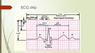 ECG strip
 