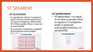 Segmen St ECG.pptx electrocardiogram cardiovascular system | PPTX