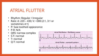 ECG.pptx electrocardiogram cardiovascular system | PPTX