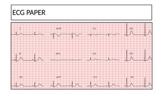 Basics of Ecg interpretation in pediatrics.pptx