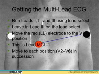 ekg lead placement and aquisition of 12 lead electrocardiogram.pdf